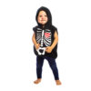 Infant Skeleton